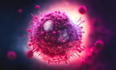 hiv